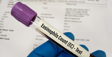 Absolute-Eosinophil-Count Absolute Eosinophil Count