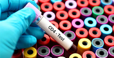 CD4-COUNT electrolytes with calcium test