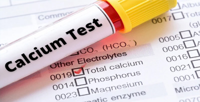 Calcium-Serum Calcium Serum