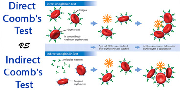 Coombs-Test-Direct-and-Indi G6PD Quantitative
