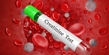 Creatinine-serum
