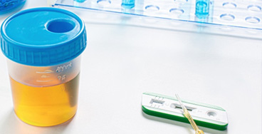 Culture-urine