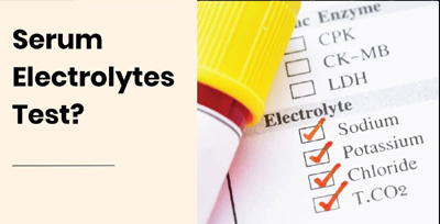Electrolytes-Serum Electrolytes Serum