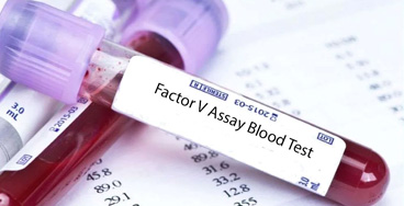 Factor-V-and-Factor-VIII Factor V and Factor VIII