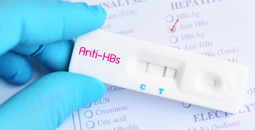 HBsAg Glucose fasting