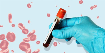 Hemogram-test