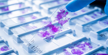 Histopathology-Examination Estimated Glomerular Filtration Rate