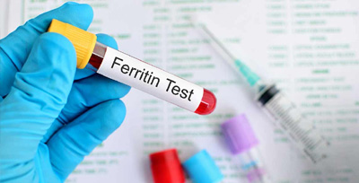Iron-Studies-with-Ferritin Iron Studies with Ferritin
