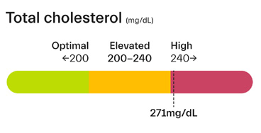 LDL-Cholesterol---Serum G6PD Quantitative