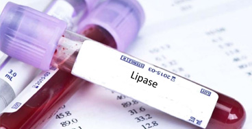 Lipase-Serum electrolytes with calcium test