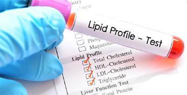 Lipid-Profile Lipid Profile