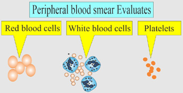 Peripheral-Smear electrolytes with calcium test