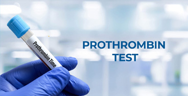 Prothrombin-Time-Studies