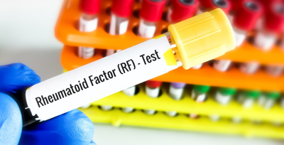 RA-Factor-Serum RA Factor Serum