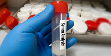 Semen-Analysis electrolytes with calcium test