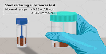 Stool-Examination,-pH-&-Red Stool Examination, pH & Reducing Substances