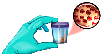 Stool-Occult-Blood Stool Occult Blood
