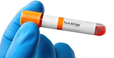 Torch-8-Profile G6PD Quantitative