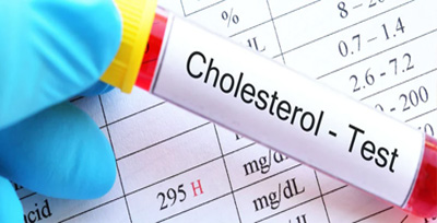 Total-Cholesterol Glucose fasting