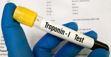 Troponin-I-and-T-Qualitativ G6PD Quantitative