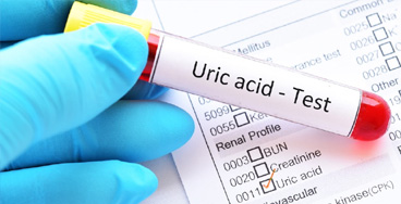 Uric-Acid-Serum