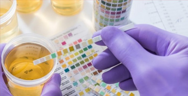 Urine-examination-routine