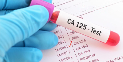 ca125-test ESR Test