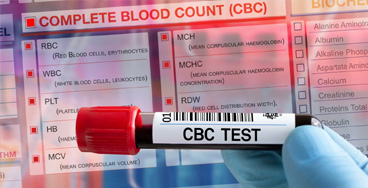 cbc-test