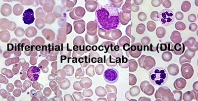 dlc-count sputum examination for afb
