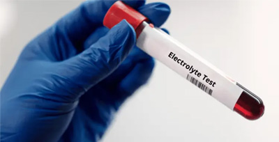 electrolytes-with-calcium-t electrolytes with calcium test