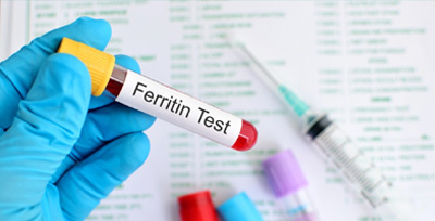 ferritin-test ESR Test