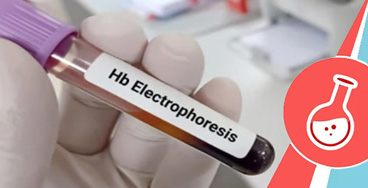 hb-electrophoresis