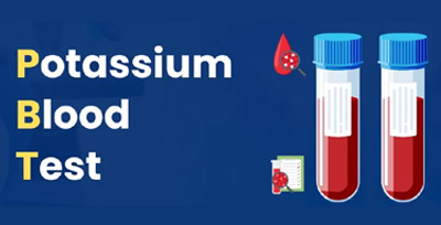 serum-potassium serum potassium