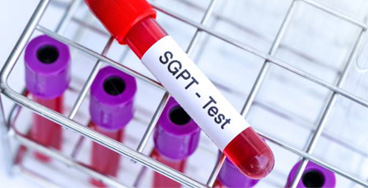sgpt Glucose fasting