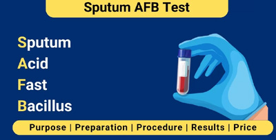 sputum-examination-for-afb sputum examination for afb