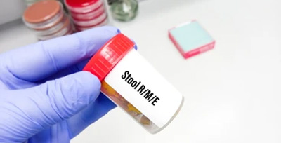 stool-rm Electrolytes Serum