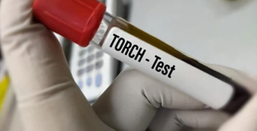 torch