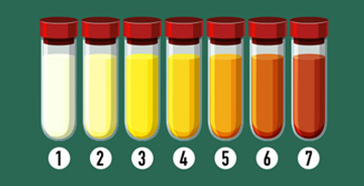 urea-serum
