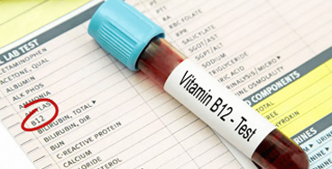 vitamin-b12-test