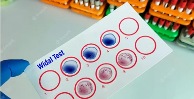 widal-test